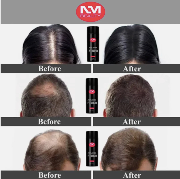 Hair Building Fibers, Hair Powder Spray, Hair Loss Concealer Fiber Black/ Dark Brown