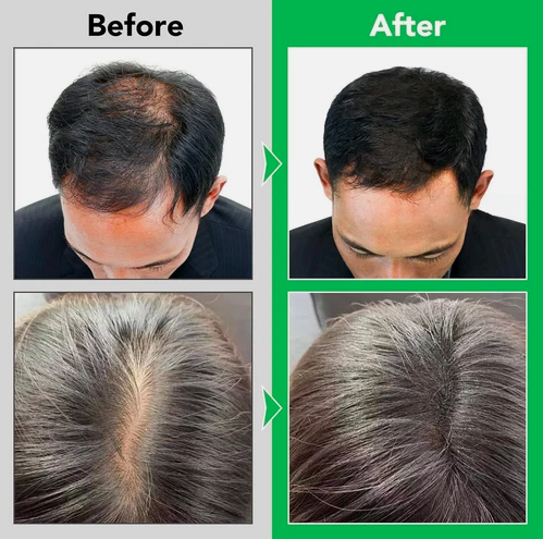 Vedic Rosemary Shampoo for Hair Growth, with Mint, Organic Hair Growth 300ml