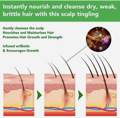 Vedic Rosemary Shampoo for Hair Growth, with Mint, Organic Hair Growth 300ml