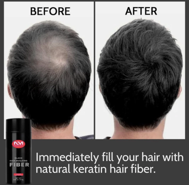 Hair Building Fibers, Hair Powder Spray, Hair Loss Concealer Fiber, Black, NMB